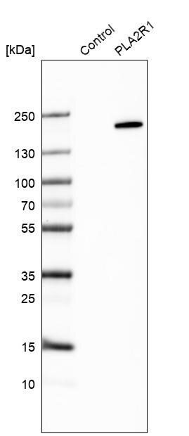 PLA2R1 Antibody - BSA Free Western Blot: PLA2R1 Antibody - BSA Free [NBP1-84449]