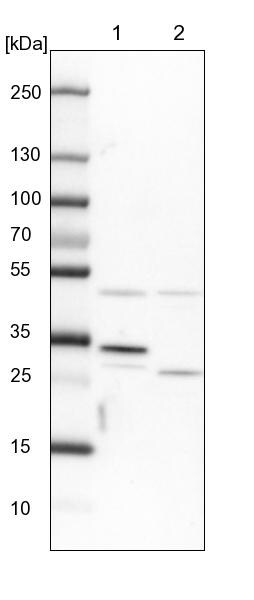 CLYBL Antibody - BSA Free Western Blot: CLYBL Antibody - BSA Free [NBP1-84453]