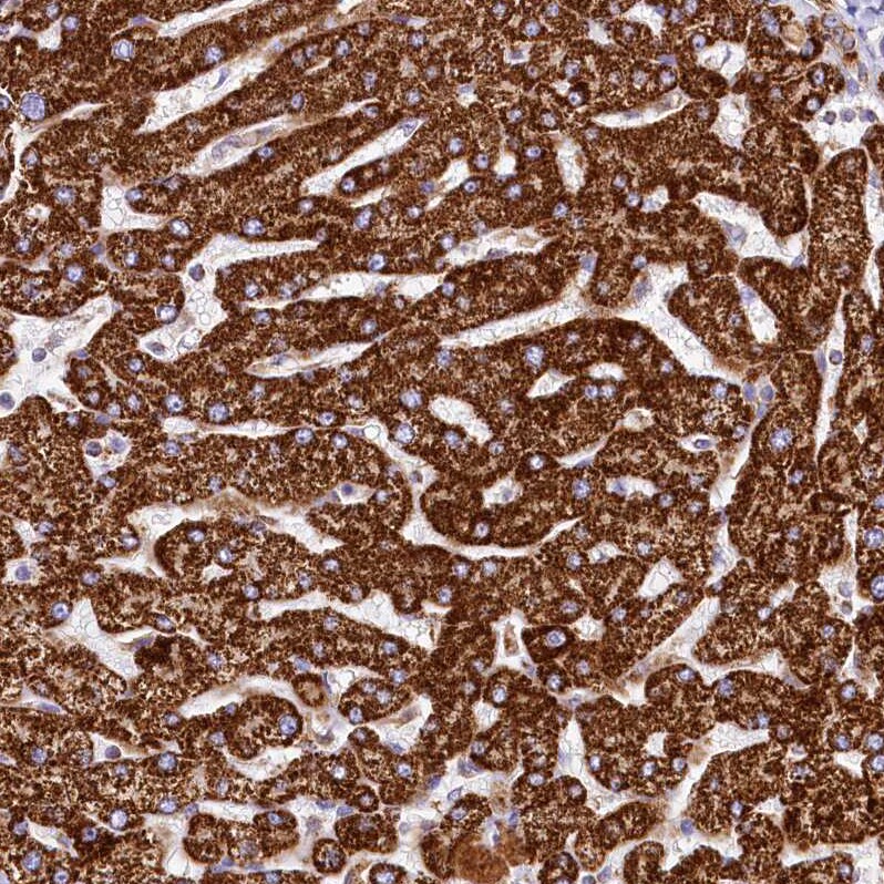 CLYBL Antibody - BSA Free Immunohistochemistry-Paraffin: CLYBL Antibody - BSA Free [NBP1-84453]