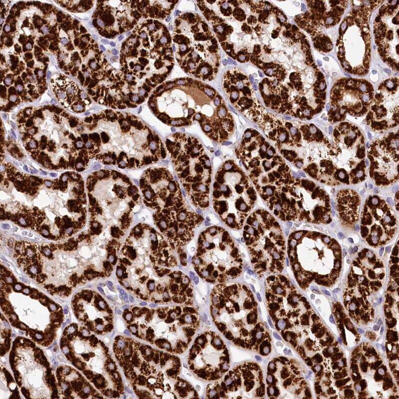 CLYBL Antibody - BSA Free Immunohistochemistry-Paraffin: CLYBL Antibody - BSA Free [NBP1-84453]