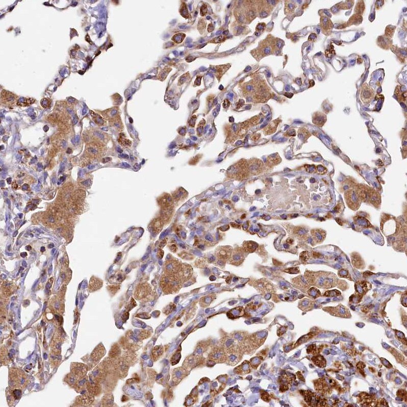 CLYBL Antibody - BSA Free Immunohistochemistry-Paraffin: CLYBL Antibody - BSA Free [NBP1-84453]