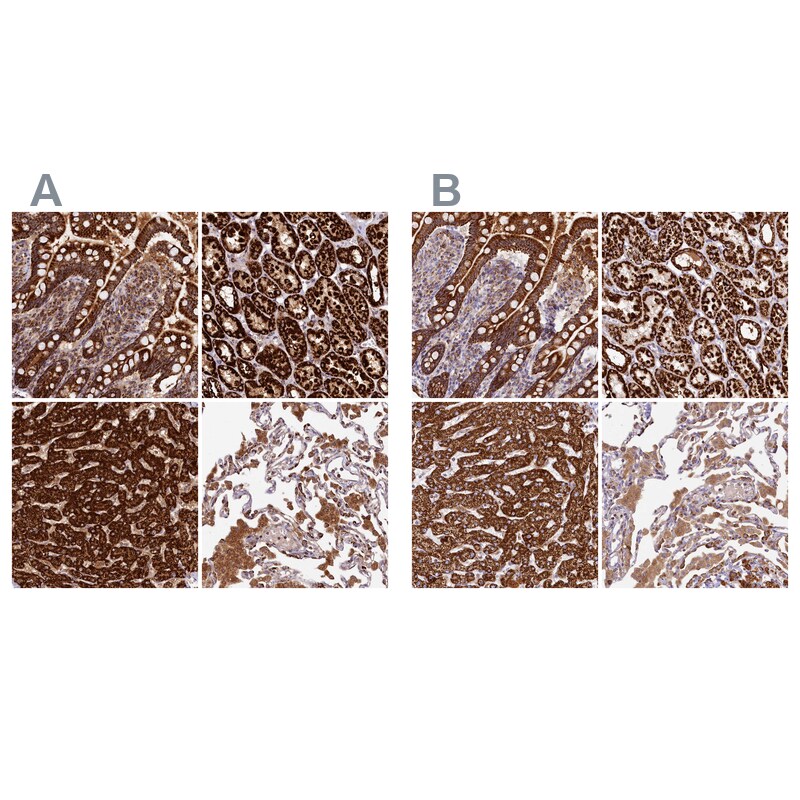 CLYBL Antibody - BSA Free Immunohistochemistry-Paraffin: CLYBL Antibody - BSA Free [NBP1-84454]