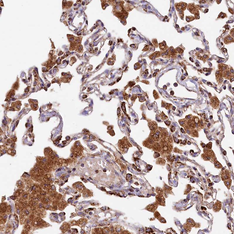 CLYBL Antibody - BSA Free Immunohistochemistry-Paraffin: CLYBL Antibody - BSA Free [NBP1-84454]