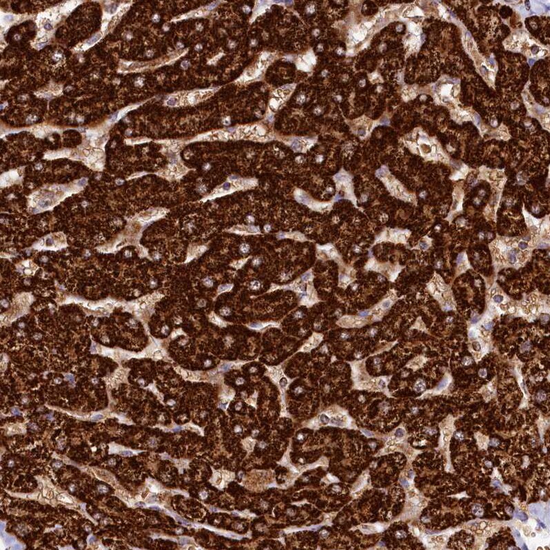 CLYBL Antibody - BSA Free Immunohistochemistry-Paraffin: CLYBL Antibody - BSA Free [NBP1-84454]