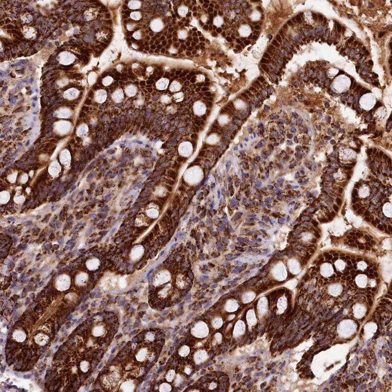 CLYBL Antibody - BSA Free Immunohistochemistry-Paraffin: CLYBL Antibody - BSA Free [NBP1-84454]
