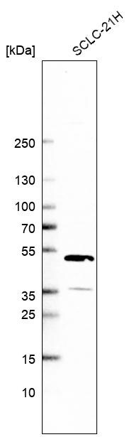 CLYBL Antibody - BSA Free Western Blot: CLYBL Antibody - BSA Free [NBP1-84454]