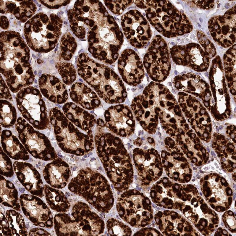 CLYBL Antibody - BSA Free Immunohistochemistry-Paraffin: CLYBL Antibody - BSA Free [NBP1-84454]