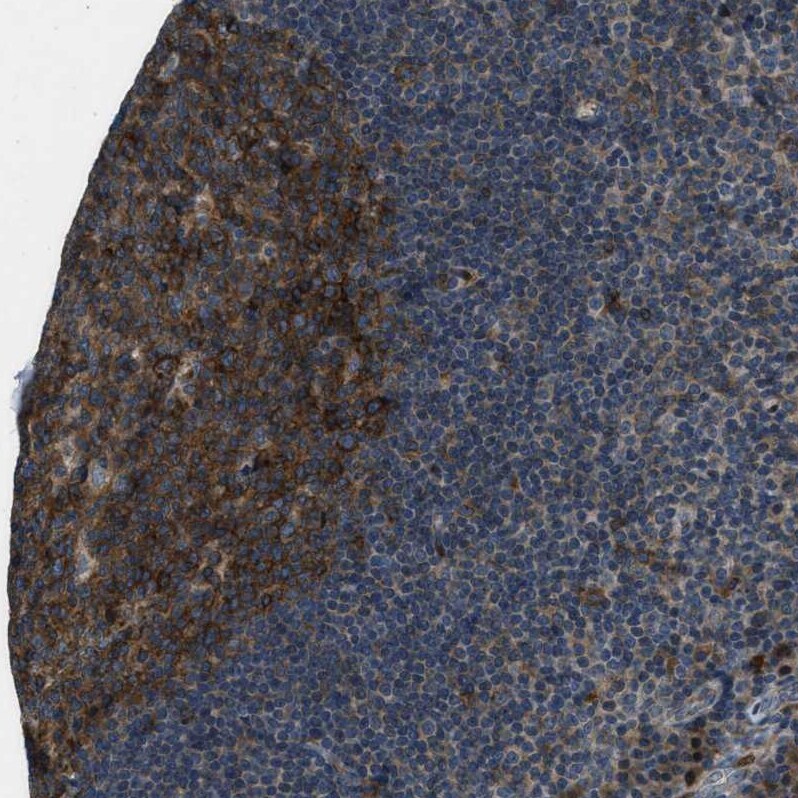 OCIL/CLEC2d Antibody - BSA Free Immunohistochemistry-Paraffin: OCIL/CLEC2d Antibody - BSA Free [NBP1-84455]