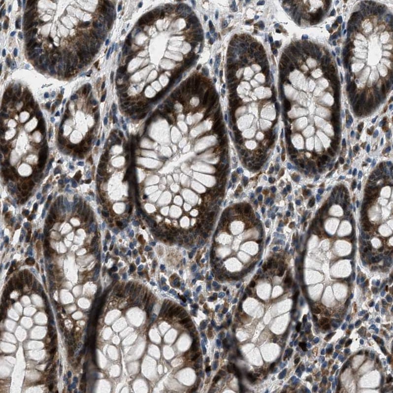OCIL/CLEC2d Antibody - BSA Free Immunohistochemistry-Paraffin: OCIL/CLEC2d Antibody - BSA Free [NBP1-84455]