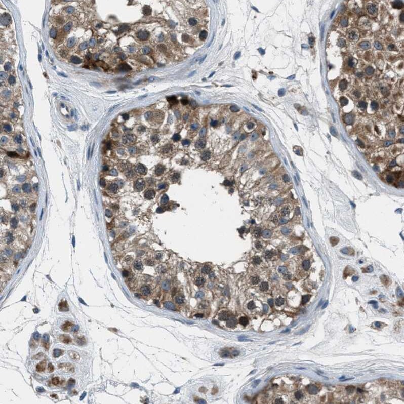 OCIL/CLEC2d Antibody - BSA Free Immunohistochemistry-Paraffin: OCIL/CLEC2d Antibody - BSA Free [NBP1-84455]