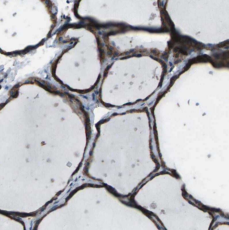 CMTM4 Antibody - BSA Free Immunohistochemistry-Paraffin: CMTM4 Antibody - BSA Free [NBP1-84457]