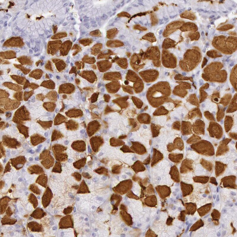 Creatine Kinase BB Antibody - BSA Free Immunohistochemistry-Paraffin: Creatine Kinase BB Antibody [NBP1-84460]