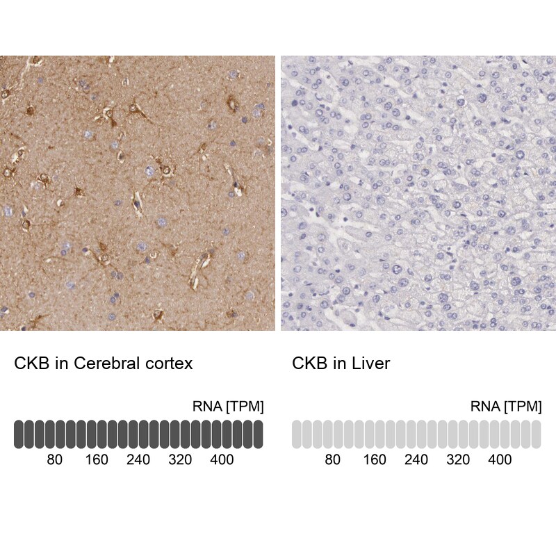 Creatine Kinase BB Antibody - BSA Free Immunohistochemistry-Paraffin: Creatine Kinase BB Antibody [NBP1-84460]
