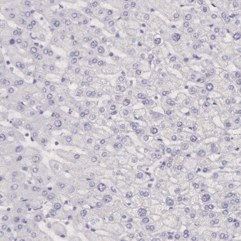 Creatine Kinase BB Antibody - BSA Free Immunohistochemistry-Paraffin: Creatine Kinase BB Antibody [NBP1-84460]