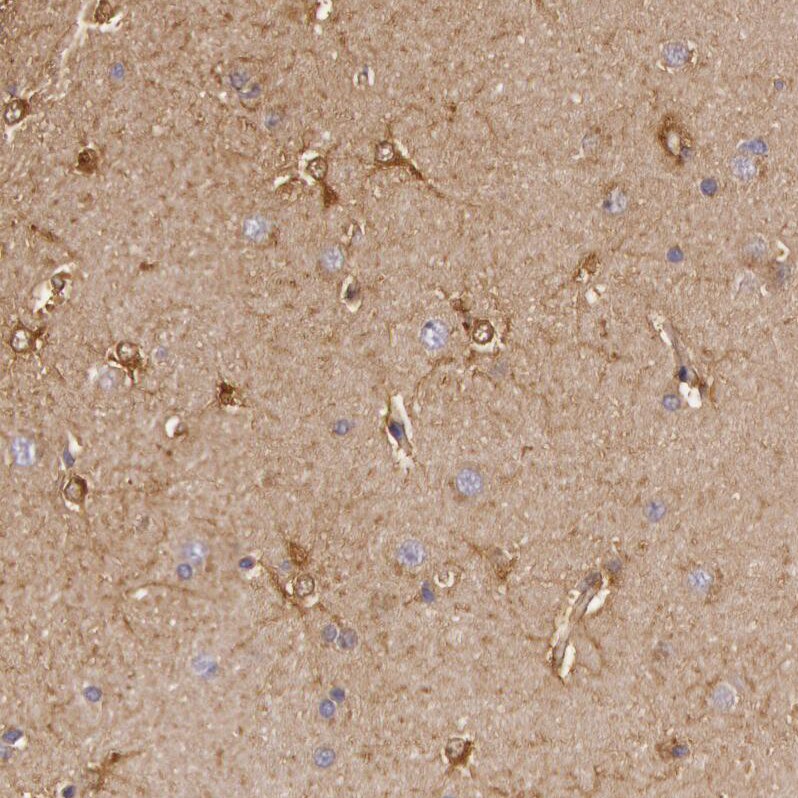 Creatine Kinase BB Antibody - BSA Free Immunohistochemistry-Paraffin: Creatine Kinase BB Antibody [NBP1-84460]