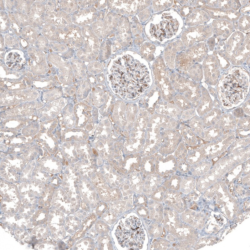Fibronectin Antibody - BSA Free Immunohistochemistry-Paraffin: Fibronectin Antibody - BSA Free [NBP1-84468]
