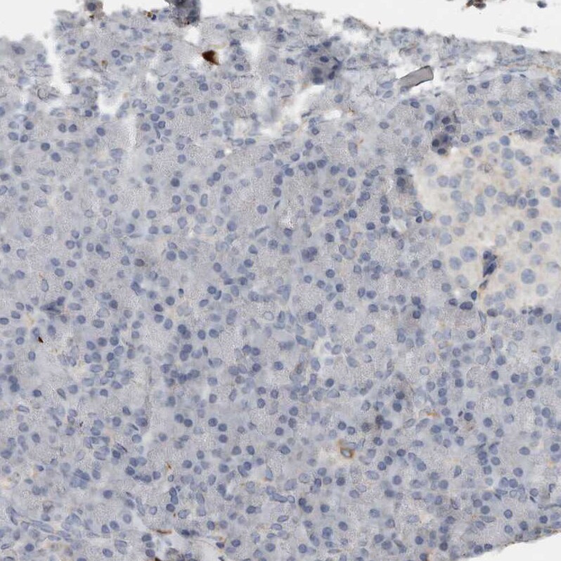 Fibronectin Antibody - BSA Free Immunohistochemistry-Paraffin: Fibronectin Antibody - BSA Free [NBP1-84468]