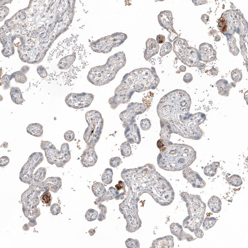 Fibronectin Antibody - BSA Free Immunohistochemistry-Paraffin: Fibronectin Antibody - BSA Free [NBP1-84468]