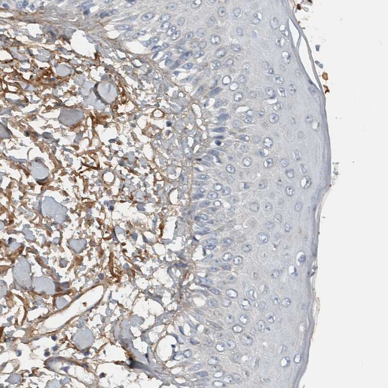 Fibronectin Antibody - BSA Free Immunohistochemistry-Paraffin: Fibronectin Antibody - BSA Free [NBP1-84468]