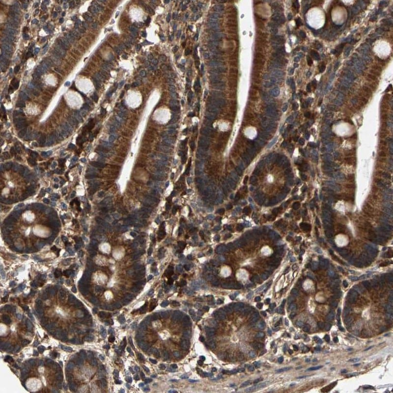 CIDEC Antibody - BSA Free Immunohistochemistry: CIDEC Antibody - BSA Free [NBP1-84469]