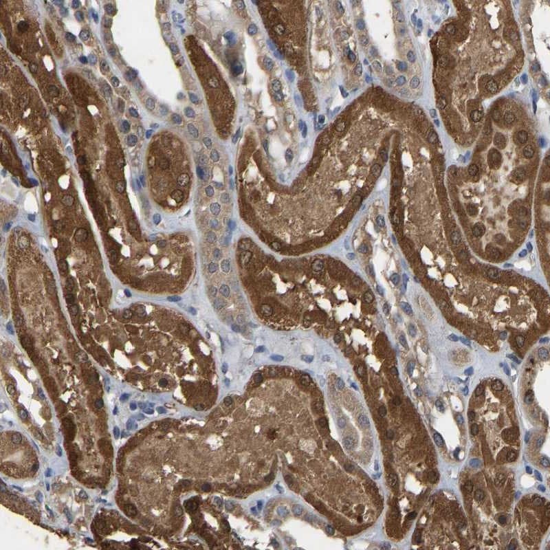 CIDEC Antibody - BSA Free Immunohistochemistry: CIDEC Antibody - BSA Free [NBP1-84470]