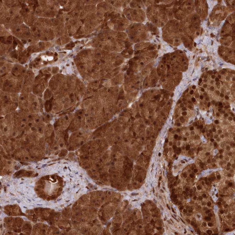 ABHD14B Antibody - BSA Free Immunohistochemistry-Paraffin: ABHD14B Antibody [NBP1-84472]