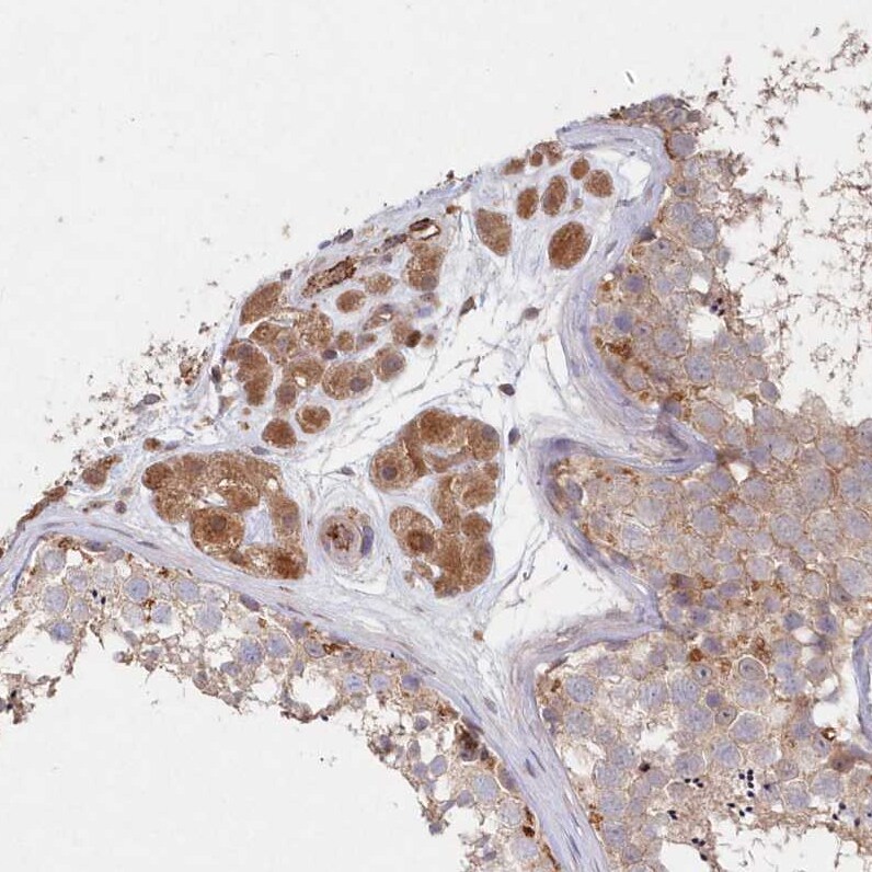 ABHD14B Antibody - BSA Free Immunohistochemistry-Paraffin: ABHD14B Antibody - BSA Free [NBP1-84473]