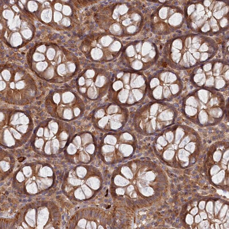 ABHD14B Antibody - BSA Free Immunohistochemistry-Paraffin: ABHD14B Antibody - BSA Free [NBP1-84473]