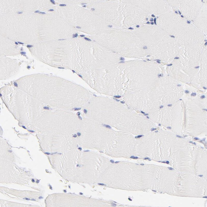 CHX10 Antibody - BSA Free Immunohistochemistry-Paraffin: CHX10 Antibody [NBP1-84476]
