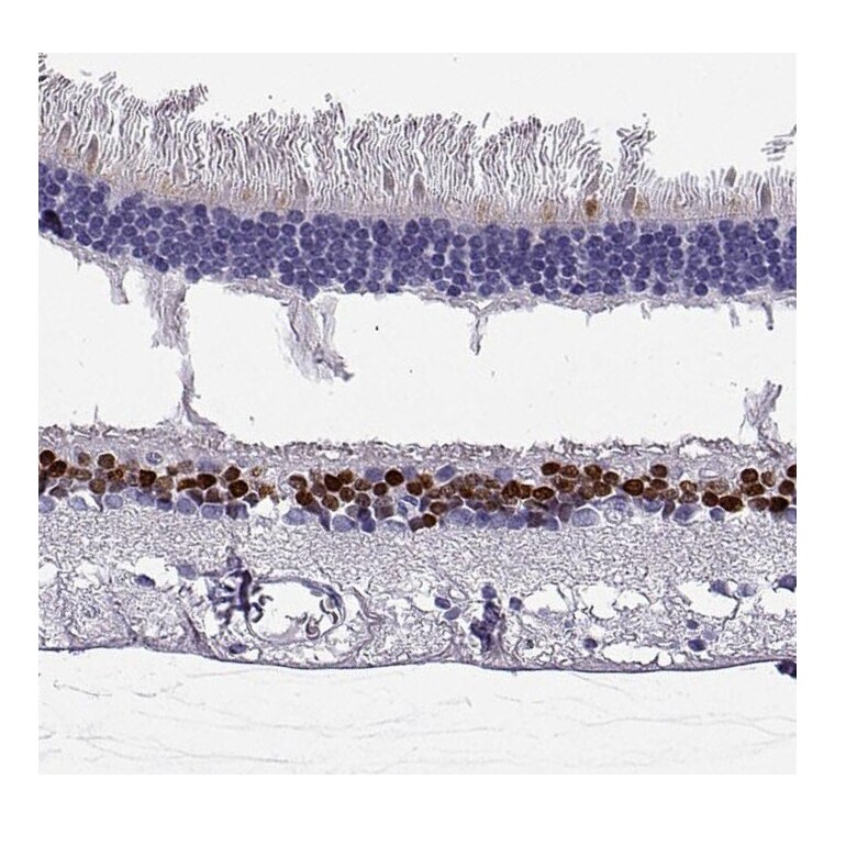 CHX10 Antibody - BSA Free Immunohistochemistry-Paraffin: CHX10 Antibody [NBP1-84476]