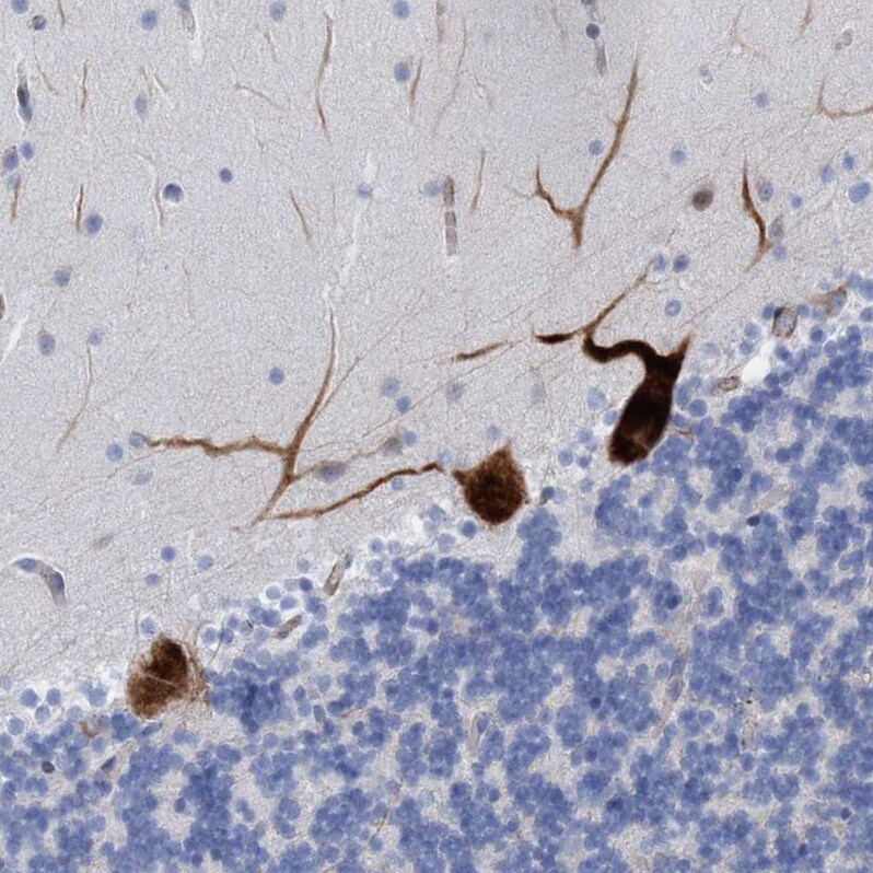 Mitochondrial fission regulator 1 Antibody - BSA Free Immunohistochemistry-Paraffin: Mitochondrial fission regulator 1 Antibody - BSA Free [NBP1-84480]