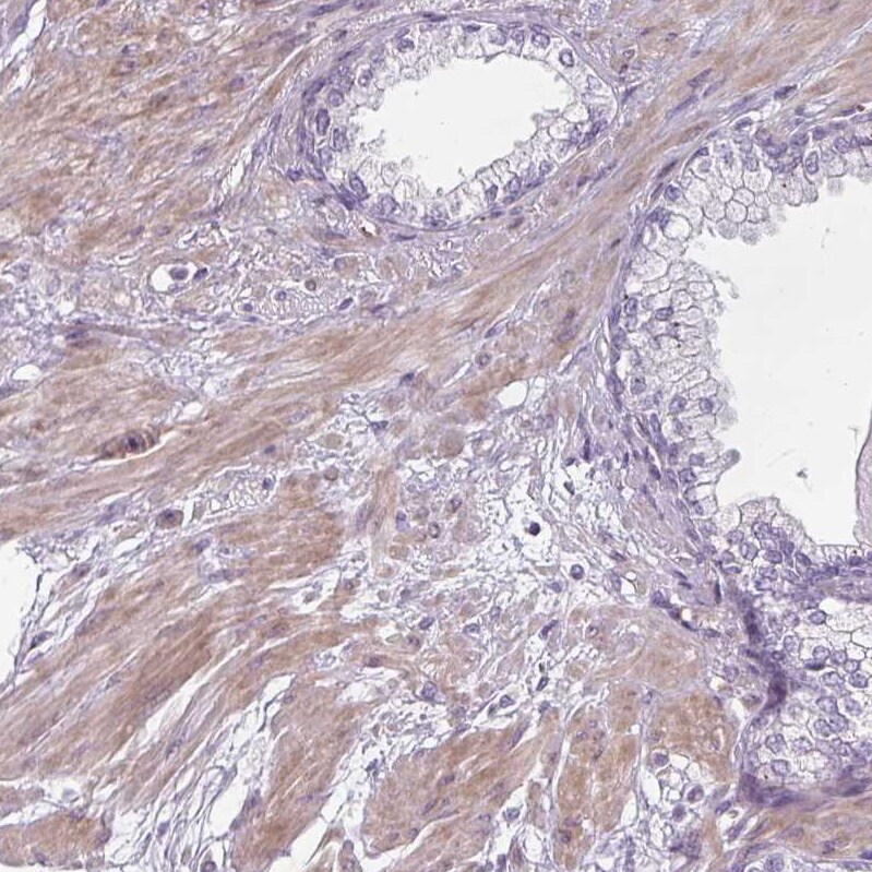 Chordin-like 1/CHRDL1 Antibody - BSA Free Immunohistochemistry-Paraffin: Chordin-like 1/CHRDL1 Antibody - BSA Free [NBP1-84485]