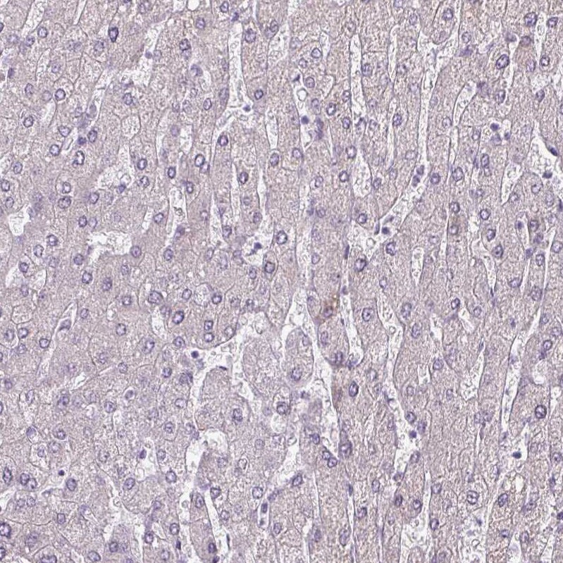 Chordin-like 1/CHRDL1 Antibody - BSA Free Immunohistochemistry-Paraffin: Chordin-like 1/CHRDL1 Antibody - BSA Free [NBP1-84485]