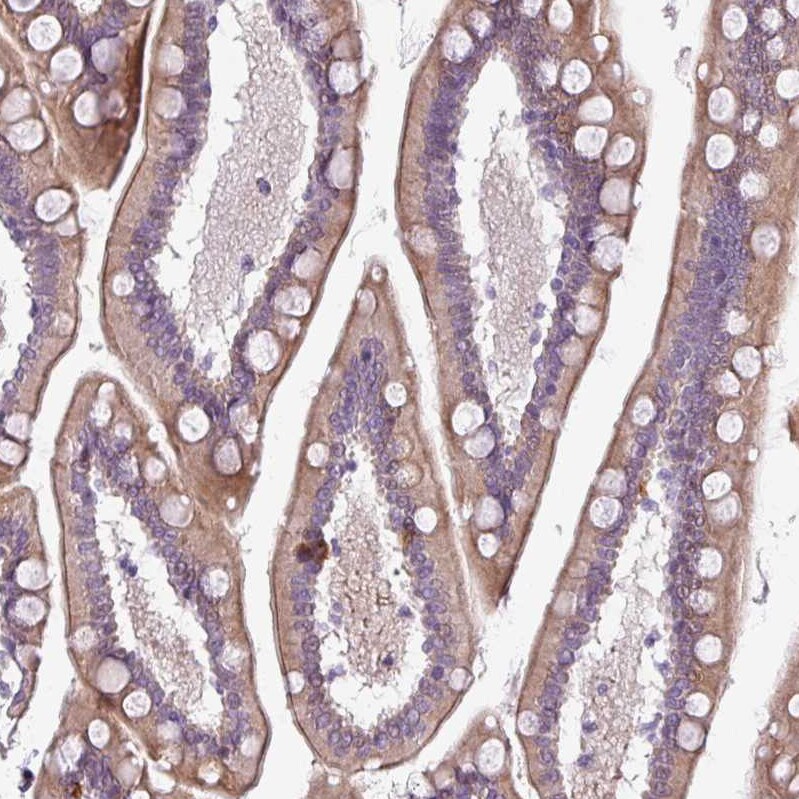 Chordin-like 1/CHRDL1 Antibody - BSA Free Immunohistochemistry-Paraffin: Chordin-like 1/CHRDL1 Antibody - BSA Free [NBP1-84485]