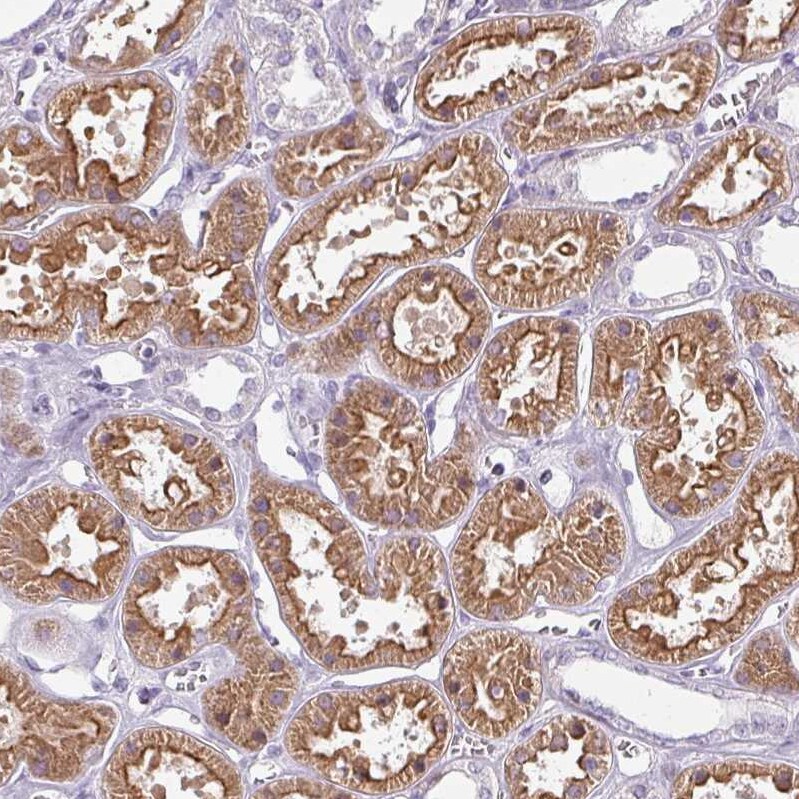 Chordin-like 1/CHRDL1 Antibody - BSA Free Immunohistochemistry-Paraffin: Chordin-like 1/CHRDL1 Antibody - BSA Free [NBP1-84485]