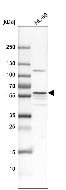 MATK Antibody - BSA Free Western Blot: MATK Antibody - BSA Free [NBP1-84487]