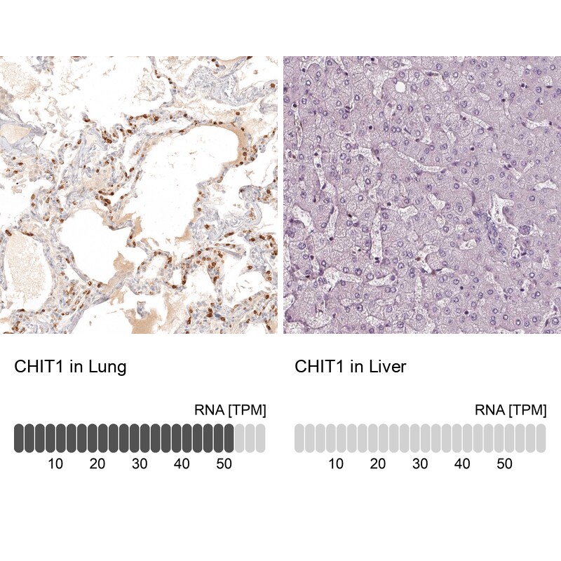 Chitotriosidase/CHIT1 Antibody - BSA Free Immunohistochemistry-Paraffin: Chitotriosidase/CHIT1 Antibody - BSA Free [NBP1-84490]