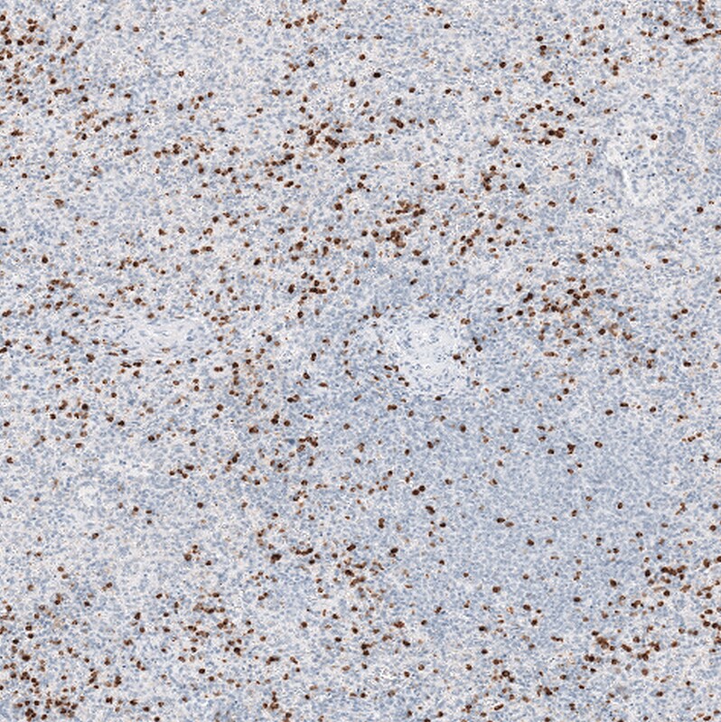 Chitotriosidase/CHIT1 Antibody - BSA Free Immunohistochemistry-Paraffin: Chitotriosidase/CHIT1 Antibody - BSA Free [NBP1-84490]