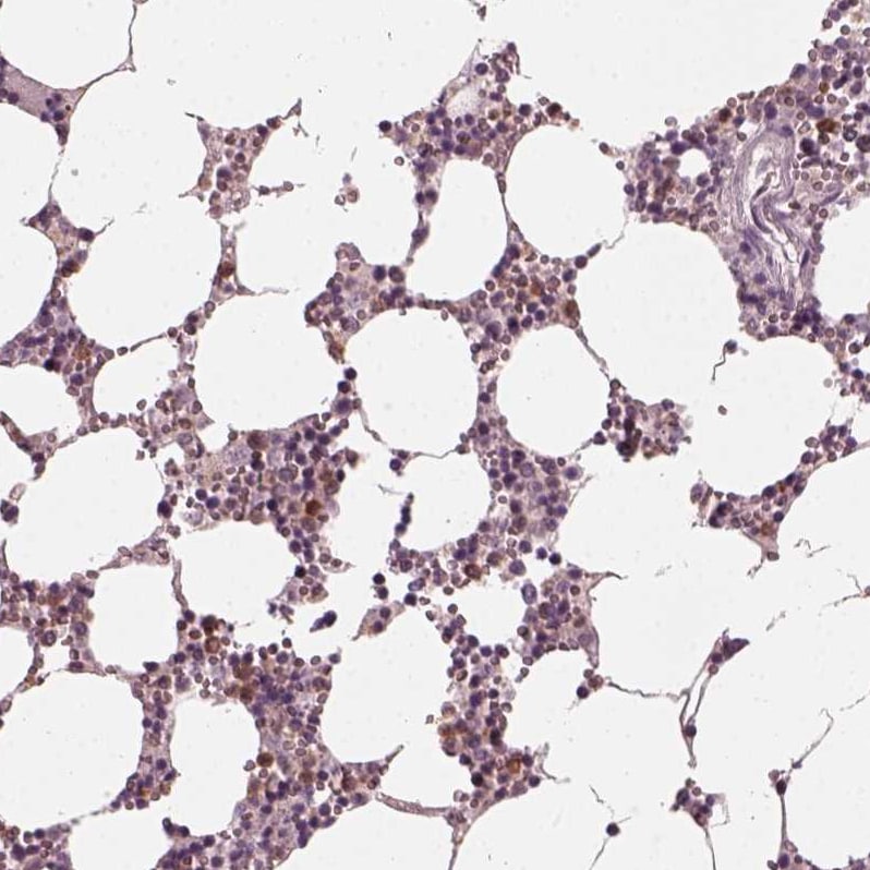 Chitotriosidase/CHIT1 Antibody - BSA Free Immunohistochemistry-Paraffin: Chitotriosidase/CHIT1 Antibody - BSA Free [NBP1-84490]