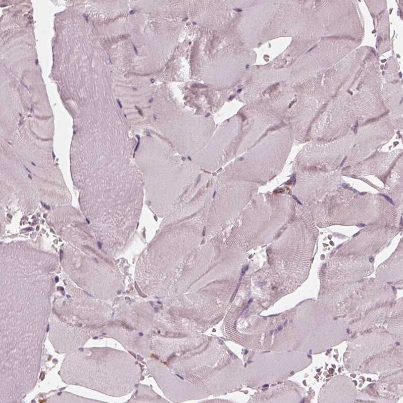 Chitotriosidase/CHIT1 Antibody - BSA Free Immunohistochemistry-Paraffin: Chitotriosidase/CHIT1 Antibody - BSA Free [NBP1-84490]