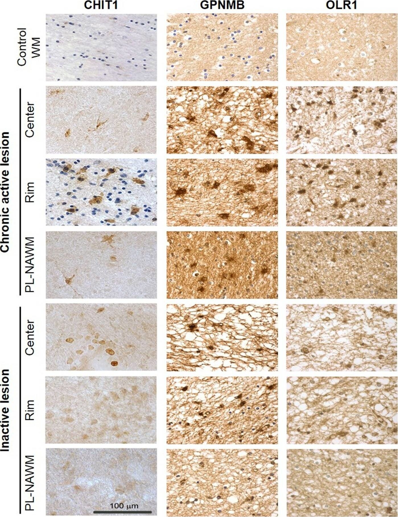 Chitotriosidase/CHIT1 Antibody - BSA Free