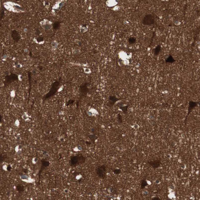 cGK2/PRKG2 Antibody - BSA Free Immunohistochemistry-Paraffin: cGK2/PRKG2 Antibody - BSA Free [NBP1-84497]