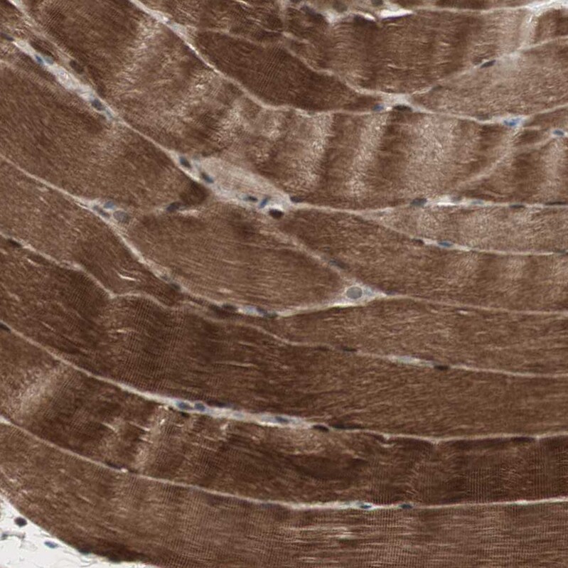 cGK2/PRKG2 Antibody - BSA Free Immunohistochemistry-Paraffin: cGK2/PRKG2 Antibody - BSA Free [NBP1-84497]