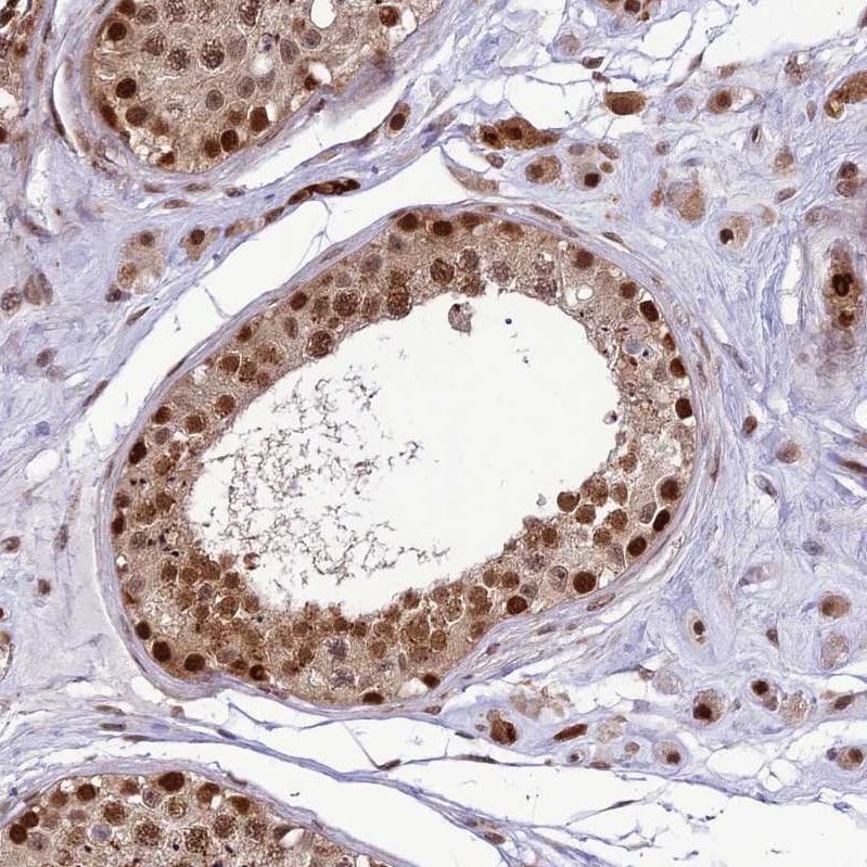 CLE7 homolog Antibody - BSA Free Immunohistochemistry-Paraffin: CLE7 homolog Antibody - BSA Free [NBP1-84498]
