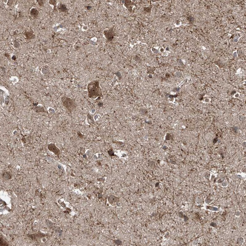 ZDHHC9 Antibody - BSA Free Immunohistochemistry: ZDHHC9 Antibody [NBP1-84499]