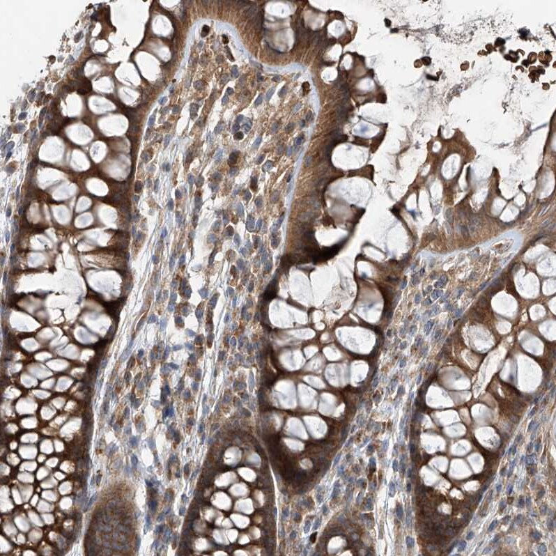 ZDHHC9 Antibody - BSA Free Immunohistochemistry: ZDHHC9 Antibody [NBP1-84499]