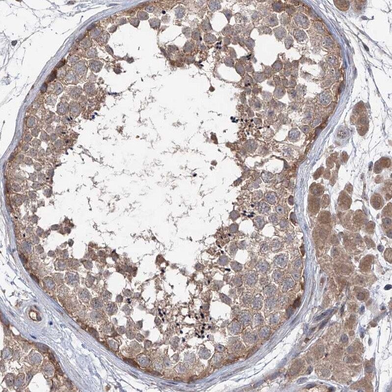 ZDHHC9 Antibody - BSA Free Immunohistochemistry: ZDHHC9 Antibody [NBP1-84499]