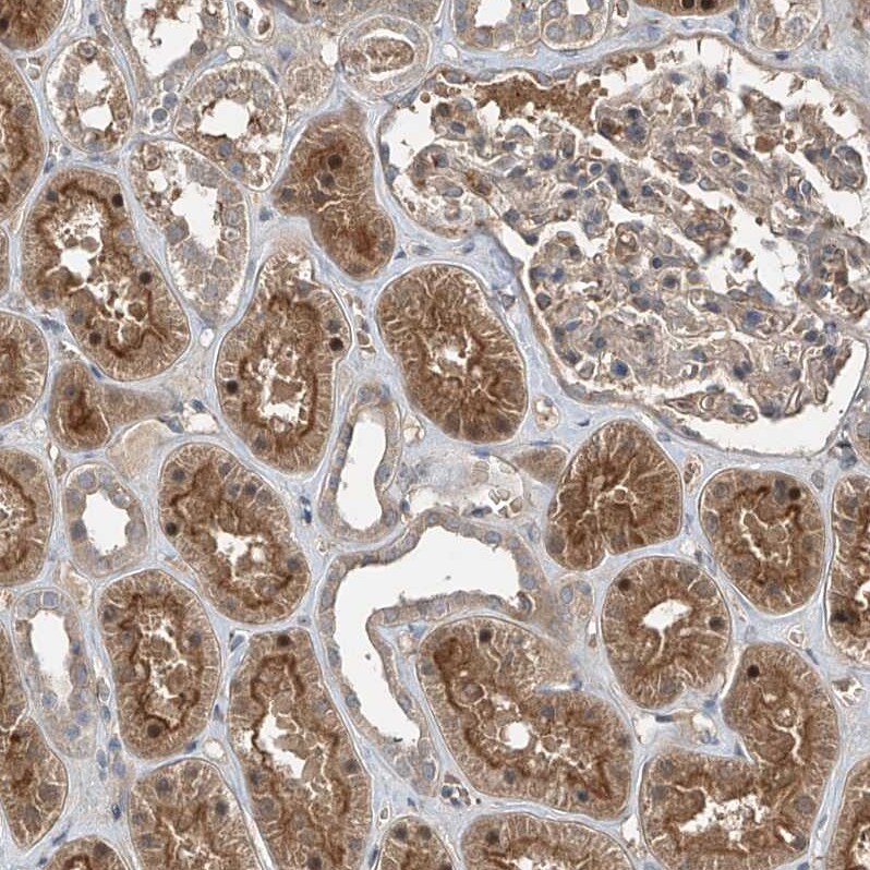 ZDHHC9 Antibody - BSA Free Immunohistochemistry: ZDHHC9 Antibody [NBP1-84499]