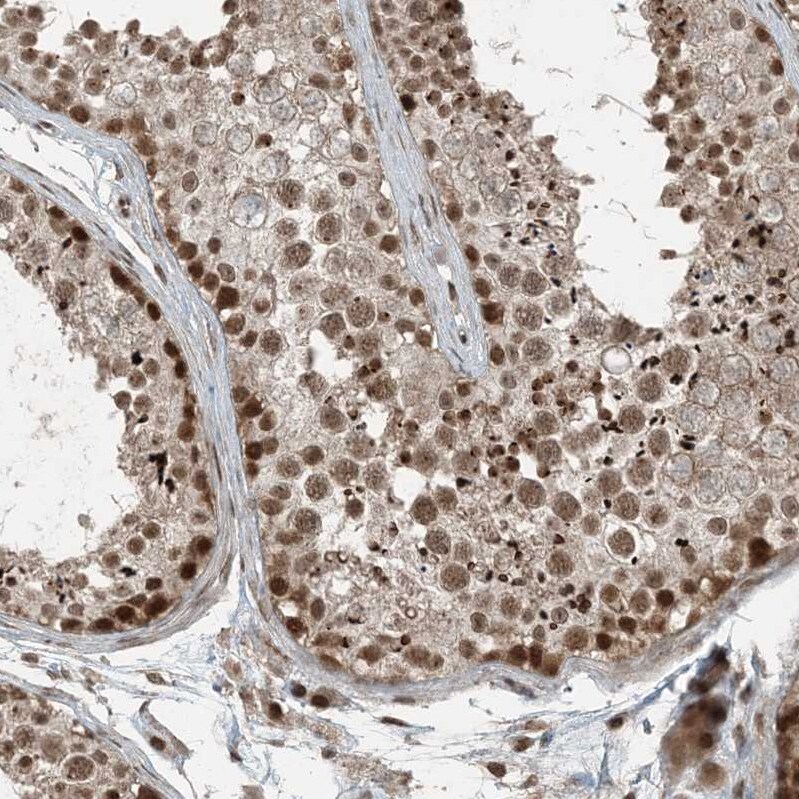TTC15 Antibody - BSA Free Immunohistochemistry-Paraffin: TTC15 Antibody - BSA Free [NBP1-84500]