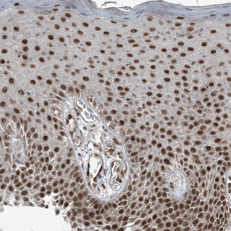 TTC15 Antibody - BSA Free Immunohistochemistry-Paraffin: TTC15 Antibody - BSA Free [NBP1-84500]